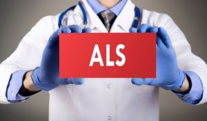 Homecare Amberley OH - Tips on Caring for Aging Relatives with ALS