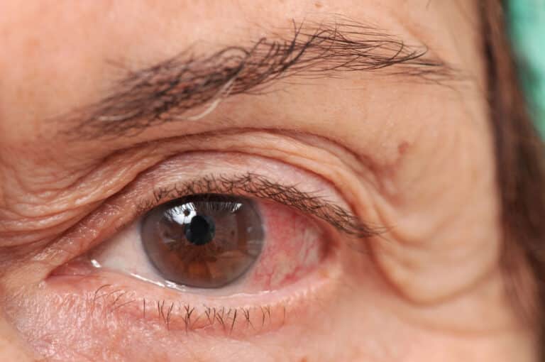 Senior home care supports independence and safety for those living with vision loss from macular degeneration.